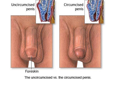 Why Adult Men Are Getting Circumcised Daily Squirt