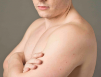 Tobias
